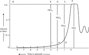 Image result for Vital Capacity