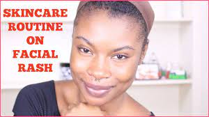 Skincare Routine| Quick Way To Get Rid Of Rash - Youtube