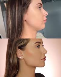 12 Plastic surgery ideas