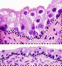 Method primarily used for research purposes and in the diagnosis of certain kidney, muscle, and cns diseases, with a higher. Animal Tissues Epithelium Transitional Epithelium Atlas Of Plant And Animal Histology