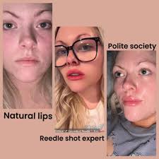 Review of top lip plumpers for noticeable results