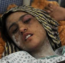 Afghaninnen haben die junge frau zu grabe getragen, die in der vergangenen woche in kabul von gewalt gegen frauen ist alltag in afghanistan. Zwangsheirat Als Frau In Afghanistan Lernst Du Dich Zu Hassen Welt