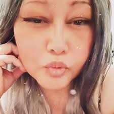 Dakota Briley, son of iconic Pipeline surfer Shawn Briley, is making  progress in his recovery after getting hit by a car