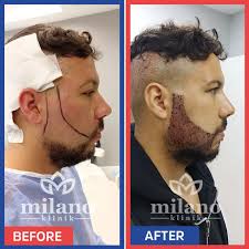 Sakal Ekimi Fiyatları İstanbul