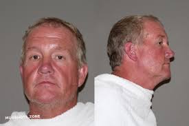 MEHL ERIC JEBSEN 08/15/2022