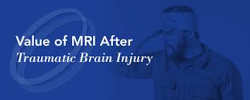 value of mri after traumatic brain injury health images