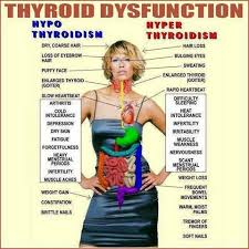 Thyroid Dysfunction Picture Chart I Guess I Have Both Hypo