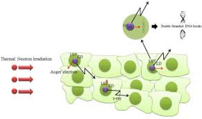 Gadolinium is a metal used in contrast materials for mris. Gadolinium Nanoparticles As Diagnostic And Therapeutic Agents Their Delivery Systems In Magnetic Resonance Imaging And Neutron Capture Therapy Sciencedirect