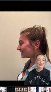 Transformative Plastic Surgery Transformations