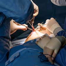 Says breast cancer specialist halle moore, md, &quot;but for certain patients it makes more sense. Breast Cancer Treatment Options Plan By Stage Guidelines