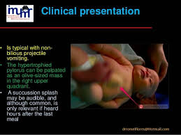 Image result for Succussion Splash