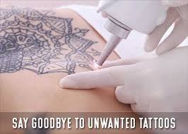 Fda office of women's health subject: Laser Tattoo Removal Celebrity Ink