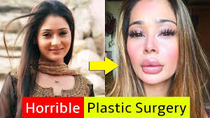 10 tv actress who looks horrible after
