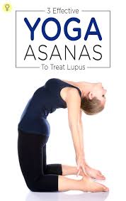 3 Effective Yoga Asanas To Treat Lupus Yoga Asanas Lupus Yoga For Knees
