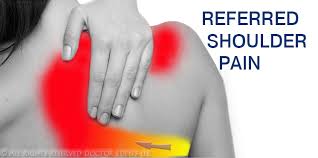 Pin On Gallbladder Symptoms