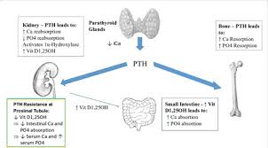 Image result for Hyperparathyroidism