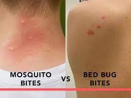 Image result for mosquito bite