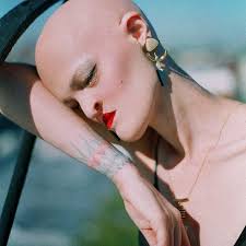 A One-of-a-Kind Model With A Rare Genetic Condition Becomes Famous