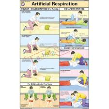 Electric Shock And Treatment Chart 50x75cm