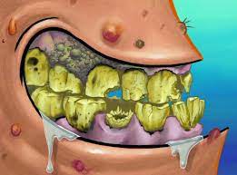 Check spelling or type a new query. You Sir Could Use Some Dental Hygiene Who Spongebob Freeze Frames