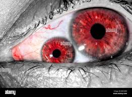 Venas Rojas En El Ojo Fotos E Imagenes De Stock Alamy