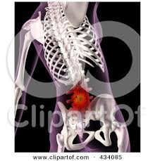 Female backs seem to have much more subtle muscle definition and smaller scapulae. An Xray Of A Female Skeleton With Lower Back Pain Posters Art Prints By Interior Wall Decor 434085