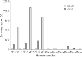 See full list on mesotheliomatreatmentcenters.org Malignant Pleural Mesothelioma History Controversy And Future Of A Manmade Epidemic European Respiratory Society