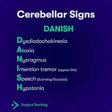 Image result for Rapid Alternating Movements