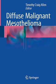 Glioblastoma is the most common type of malignant brain tumor in adults. Pin On Mesothelioma