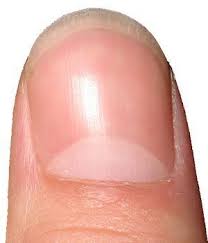 Color Of Fingernails And Toenails Health Indicator Chart