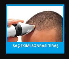 Sac Ekimi Sonrasi Tras Ne Kadar Zaman Sonra Olur Sac Ekim Sac Kesimi