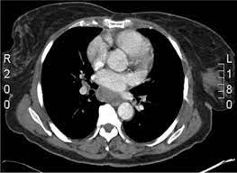 Fizz Ct Scan Ct Scan Machine