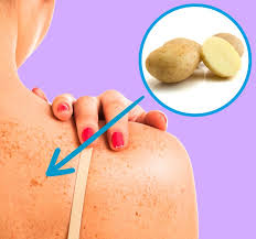The summer is coming, so it makes the perfect time for me to share this with you. 11 Ways To Remove Dark Spots From Your Skin