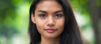 Misconceptions About Von Willebrand Disease