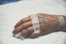 Paciente No Hospital Com Soro Fisiológico Intravenoso Na Mão De Um Paciente  Idoso Foto Royalty Free, Gravuras, Imagens e Banco de fotografias. Image  94988313