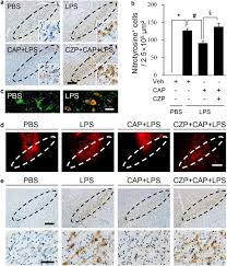 230/2007 privind înfiinţarea, organizarea şi funcţionarea asociaţiilor de proprietari: Modulation Of M1 M2 Polarization By Capsaicin Contributes To The Survival Of Dopaminergic Neurons In The Lipopolysaccharide Lesioned Substantia Nigra In Vivo Experimental Molecular Medicine