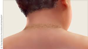 Sep 28, 2017 · roman rozenblyum/demand media. My Child S Skin Looks Dirty Or Stained What Are These Darkened Patches