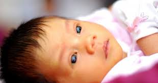 Jenis Jenis Penyakit Kuning Pada Bayi Popmama Com