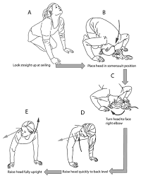 Vertigo Maneuver Epley For Benign Positional Vertigo Half Somersault Versus Epley Maneuver Vertigo Remedies Vertigo Epley Maneuver