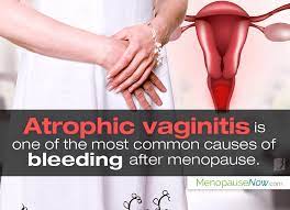 However, some types of formations that can occur during the reproductive period do not bother patients older than 50 years. Pin On Postmenopause Symptoms Causes And Treatments
