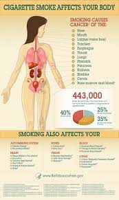 Mereka akan merokok sebelum memulakan. Kesan Merokok Terhadap Kesihatan Infografik