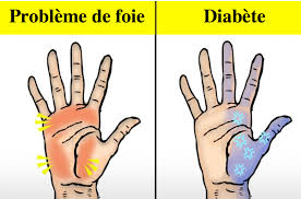 Douleurs et blessures aux doigts. 10 Choses Que Vos Mains Peuvent Reveler Au Sujet De Votre Sante Vos Mains Ont Elles Parfois Des Fourmillements Bien Etre Epoch Times