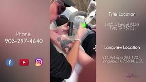 Created by franco vescovi, a tattoo artist & machine builder for 25+ years. Shreveport Bossier City La Laser Tattoo Removal Vanish Laser Aesthetics