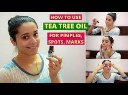 How To Use Tea Tree Oil For Pimple Acne Pimple Spots Blemishes Just Another Girl Youtube