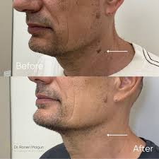 היום נערך הכנס השנתי לרפואת עור. זהו הכנס המרכזי והגדול ביותר בארץ, בו  מועברים מירב העדכונים והמידע על התרופות והטיפולים החדשים ברפואת עור. בתמונה  לפניכם 2 דורות של רופאי עור. ד"ר רונן