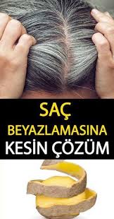 Sadece Patates Kullanarak Beyaz Saclardan Kurtulun Natural Hair Styles Beauty Hacks Beauty