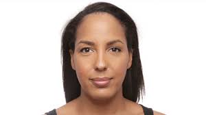 There will be some swelling and bruising around the eyes that will subside over the the degree of advancement will depend on laxity and your goals. Forehead Reduction Surgery Is A Thing We Did It Blog Huda Beauty