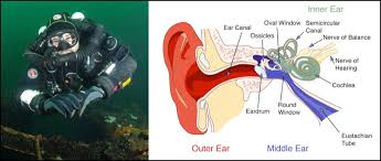 Image result for Inner Ear Decompression Sickness