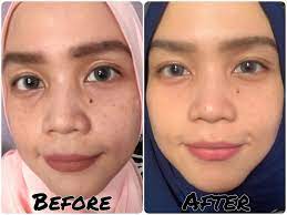 Sy pengguna digivet, aplikasi u klinik hewan, respon untuk membantu bila ada permasalahan bagus dan kalau kami ceritakan semua keunggulan vmedis, rasanya tidak cukup halaman testimoni ini. Random Rainbow Eucerin Ultra White Spotless Review