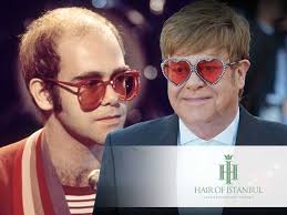 Elton John Hair Transplant: What is the Story Behind It?